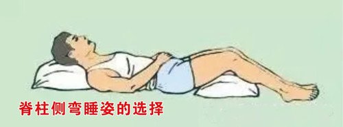 睡姿不正確會對脊柱側(cè)彎產(chǎn)生影響嗎？