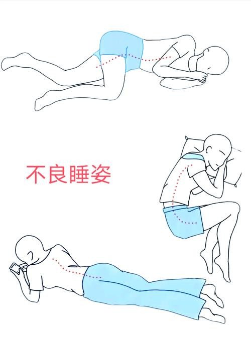睡姿對(duì)脊柱側(cè)彎患者的影響