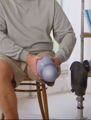 硅、凝膠套（硅膠套、凝膠套）對(duì)假肢的重要性